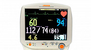 Монитор для восстановительной медицины Ростов-на-Дону