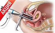 Диагностическая и операционная гистероскопия Санкт-Петербург